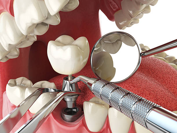 Best Same-Day Emergency Dental Services in Rolling Meadows, IL